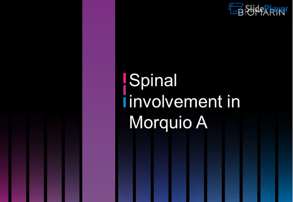Spinal Involvement In Morquio A